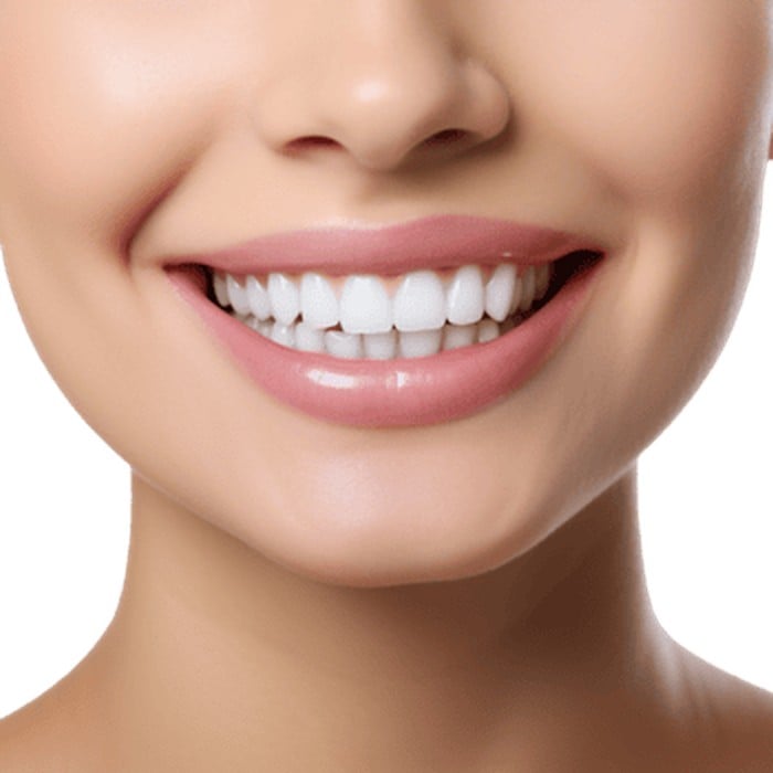 Close-up of a smile with even white teeth