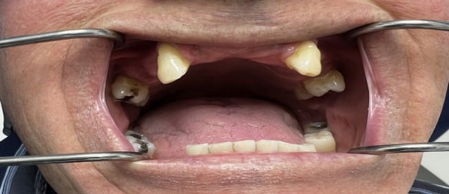Alberto, before treatment